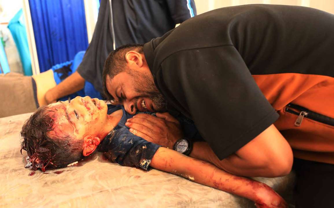 The injured and the bodies of the dead, including children, were brought to Al-Ahli Arab Baptist Hospital following an Israeli army attack on the Al-Huda and Al-Hamama schools in Gaza City's Sheikh Radwan neighborhood, where displaced Palestinians had taken shelter.