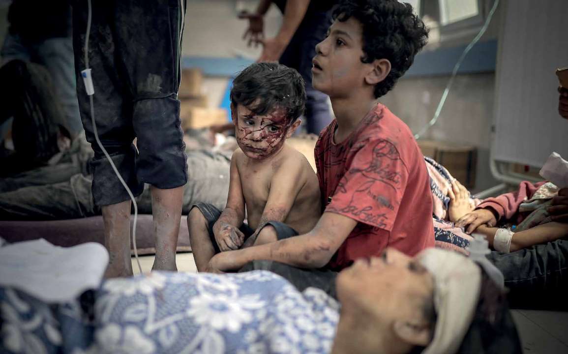 The sorrowful gaze of a young child, brought to the Al-Shifa Hospital after being injured in the attacks by the Israeli military.