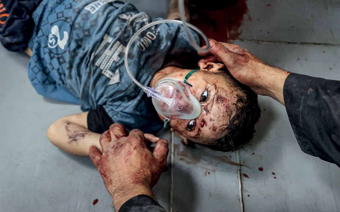 Following an Israeli army airstrike on the Al-Ahli Arab Baptist Hospital in Gaza City on October 17, 2023, in which more than 500 people were killed, numerous injured individuals were transported to the Al-Shifa Hospital.