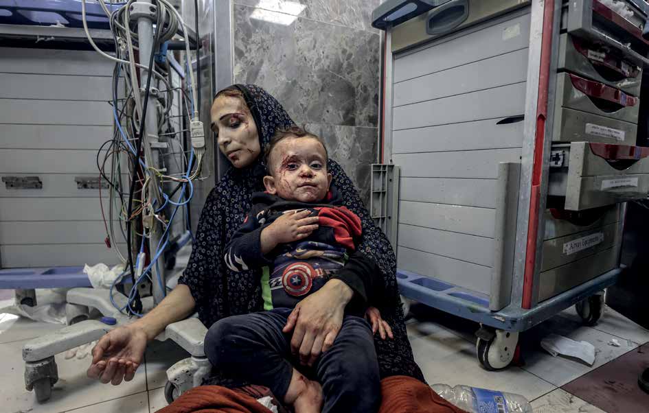 Following an Israeli army airstrike on the Al-Ahli Arab Baptist Hospital in Gaza City on October 17, 2023, in which more than 500 people were killed, many wounded people were transported to the Al-Shifa Hospital. Among them were a wounded Palestinian mother and her wounded child.