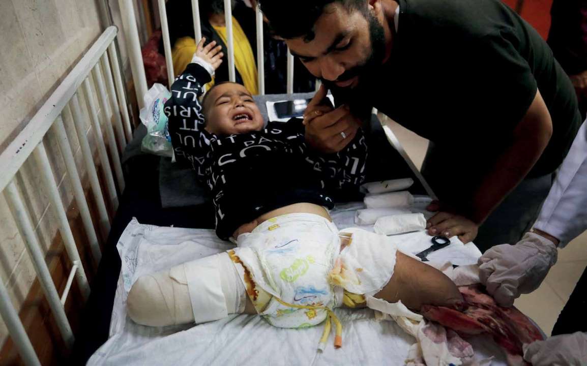 Three-year-old Palestinian child Ahmed Shabat, who survived three different Israeli attacks, cries in agony at the Al-Aqsa Martyrs Hospital in Deir Al-Balah, Gaza on November 17, 2023. After losing his parents and four siblings in the initial attack on October 7, Shabat began living with his father's relatives. Following the assault on Gaza's Sheikh Radwan neighborhood, where he lost those relatives, Shabat sought refuge in a United Nations Relief and Works Agency for Palestine Refugees in the Near East (UNRWA) school in Nuseirat Refugee Camp with his maternal uncle. Tragically, they were not spared from the subsequent attack there, either. Shabat lost both of his legs under the knees, while his uncle lost his life.