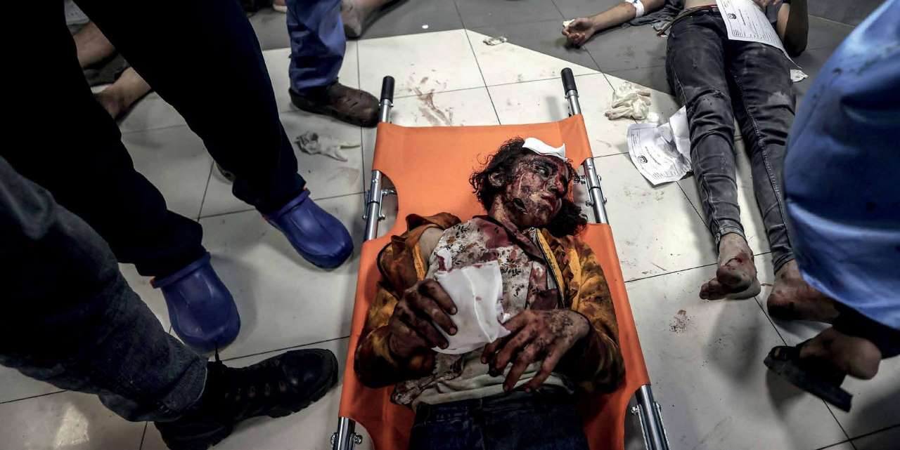 Some of the injured Palestinians who were transferred to the Al-Shifa Hospital after the Israeli army struck the Al-Ahli Arab Baptist Hospital in Gaza City on October 17, 2023, killing more than 500 people.