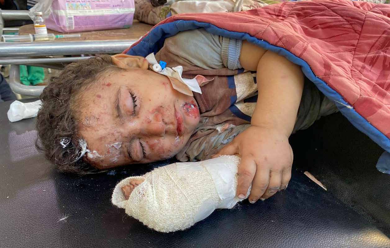 A child injured in Israeli army attacks is treated at the Al-Ahli Arab Baptist Hospital in Gaza..