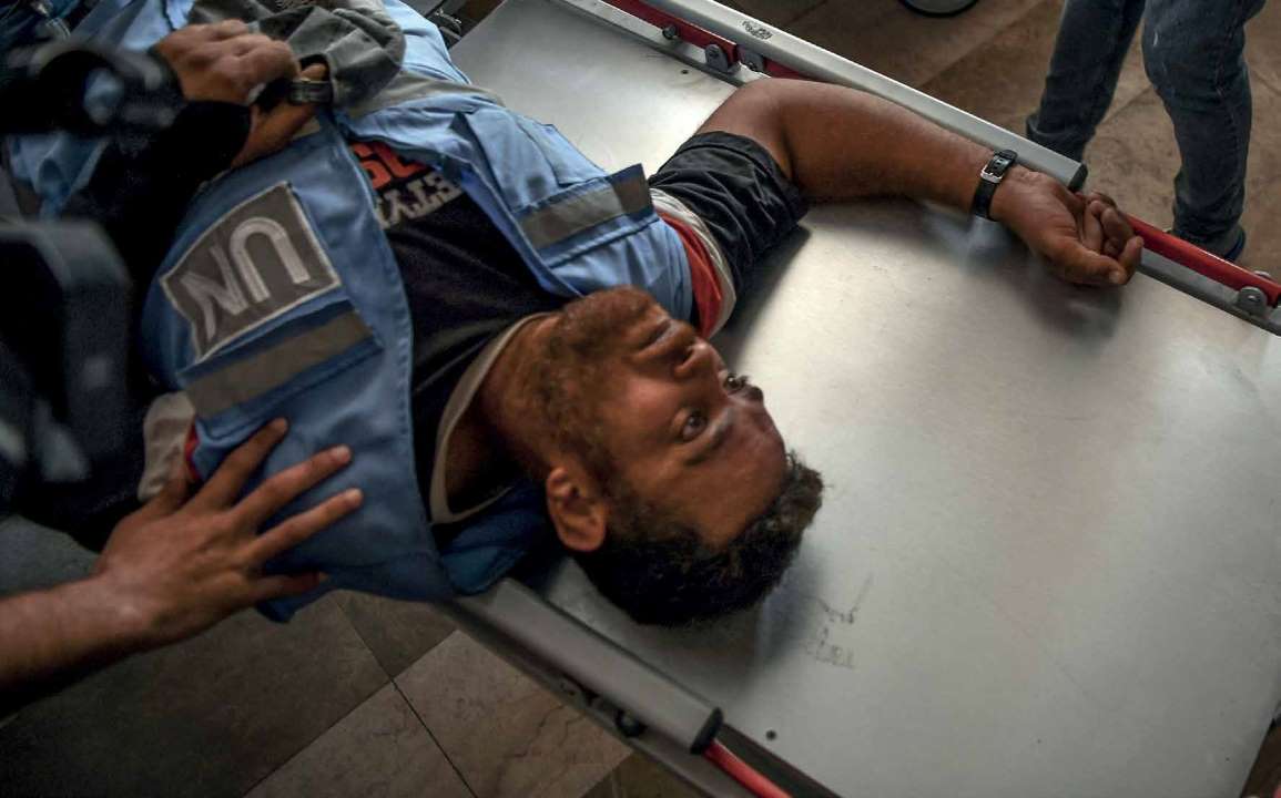 United Nations employees wounded in Israel army attacks in Khan Yunis in Gaza have been brought to the Nasser Hospital.